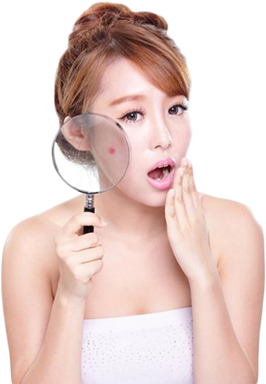 Nguyên nhân gây mụn